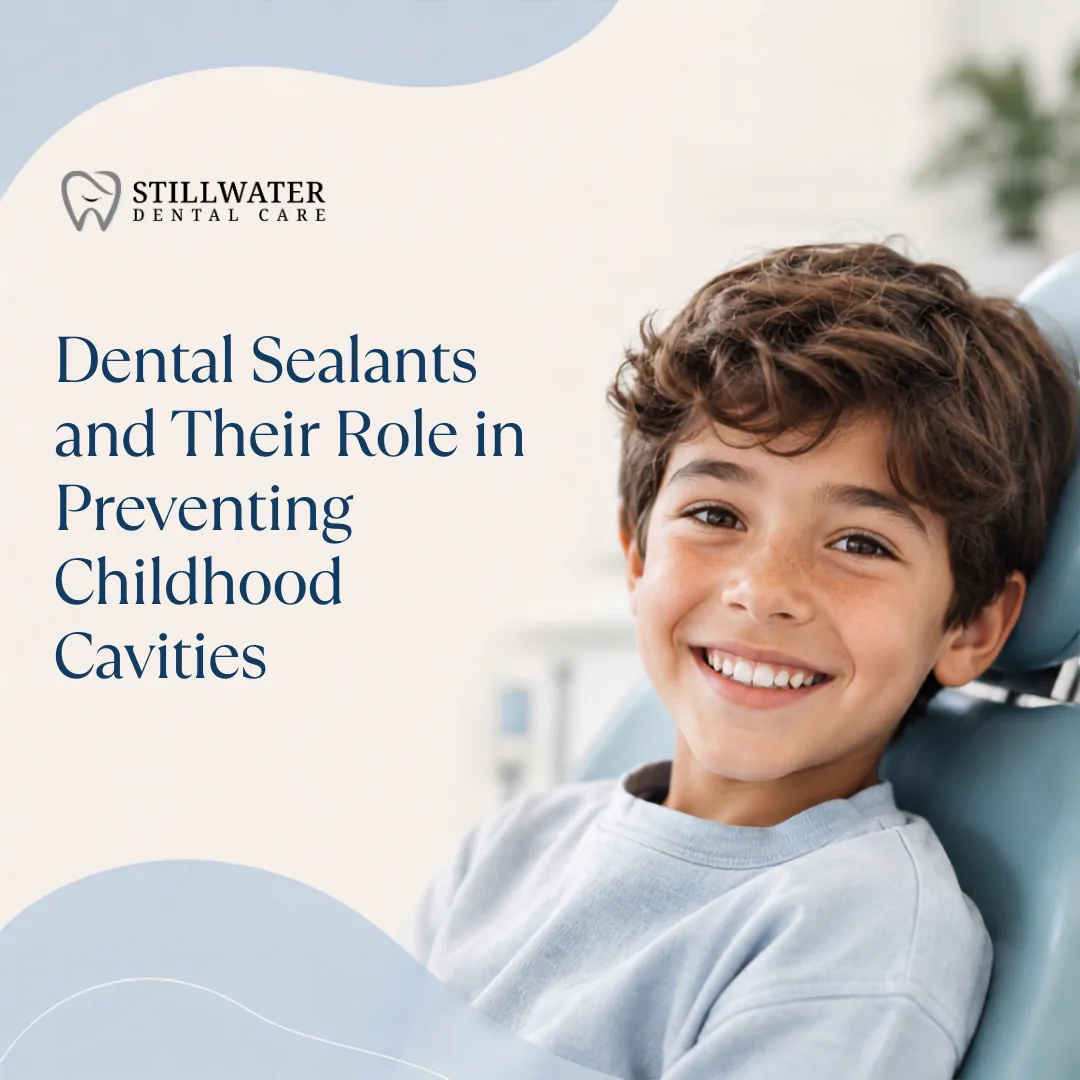 Dental Sealants and Their Role in Preventing Childhood Cavities